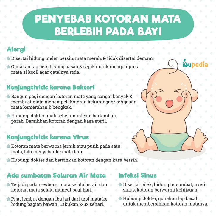 penyebab kotoran mata berlebih pada bayi