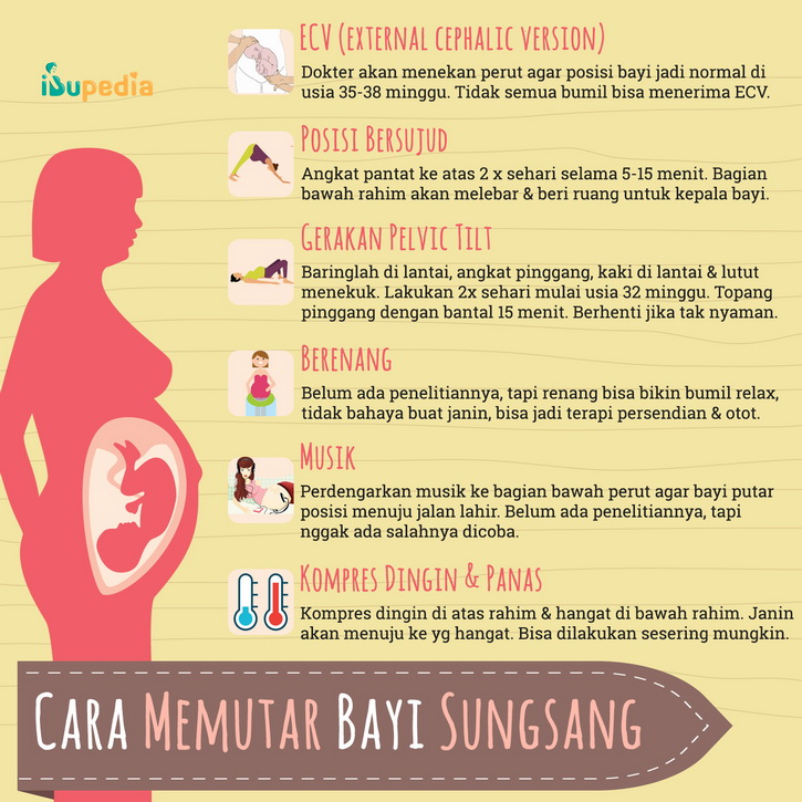 cara memutar bayi sungsang