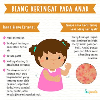 Infografis: Biang Keringat pada Anak