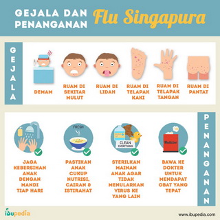 Infografis: Gejala dan Penanganan Flu Singapura